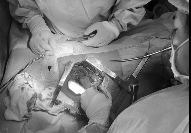 Ca phẫu thuật mở lồng ngực đầu tiên tại Trường Sa cứu sống thợ lặn nguy kịch- Ảnh 1.