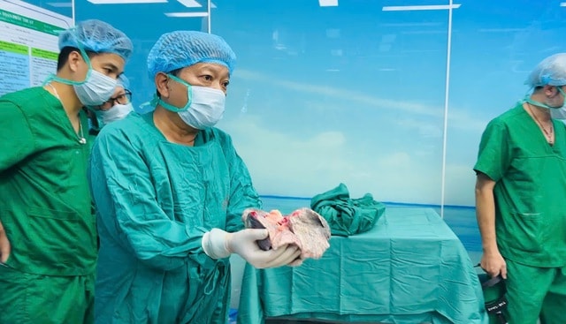 Một ngày 2 ca ghép phổi - bước ngoặt của y học Việt Nam- Ảnh 2.