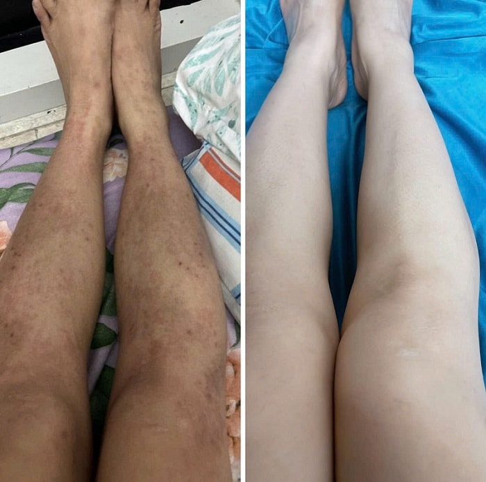 18 năm 'sống trong bóng tối' với cơ thể nhiễm H và quyết định thay đổi cuộc đời- Ảnh 2.