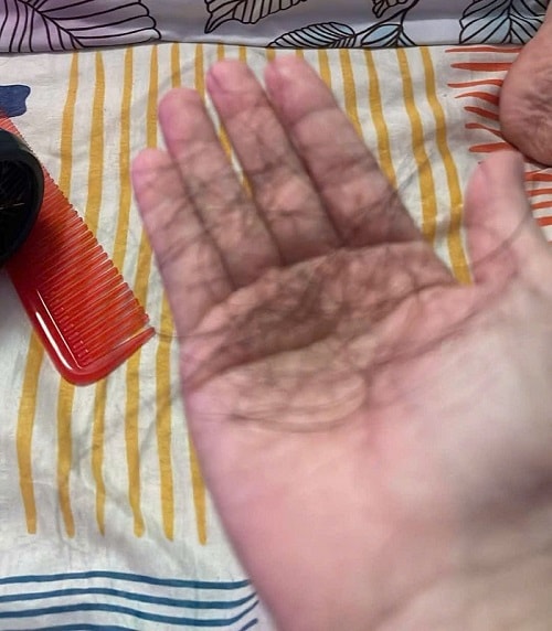 18 năm 'sống trong bóng tối' với cơ thể nhiễm H và quyết định thay đổi cuộc đời- Ảnh 3.