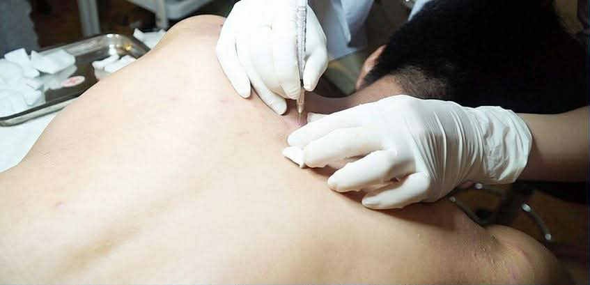 Nỗi đau không thể ngờ sau khi nhiễm H từ một lần làm đẹp tại spa- Ảnh 3.