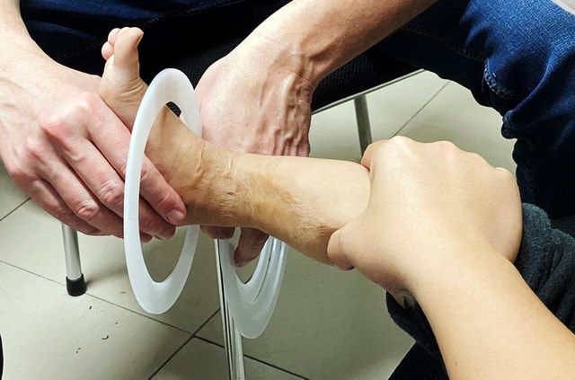 Thăm khám, phẫu thuật cho nhiều bệnh nhi mắc dị tật chênh lệch chiều dài chi- Ảnh 3.