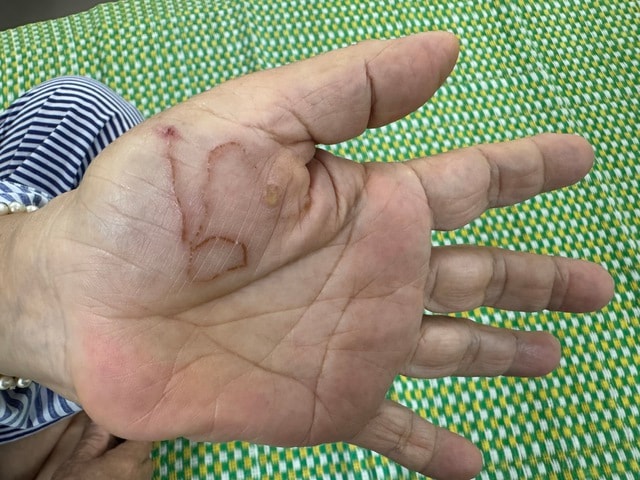 Bị nhiễm ký sinh trùng cần đi khám và điều trị ở đâu?- Ảnh 1. Bị nhiễm ký sinh trùng cần đi khám và điều trị ở đâu?- Ảnh 1.