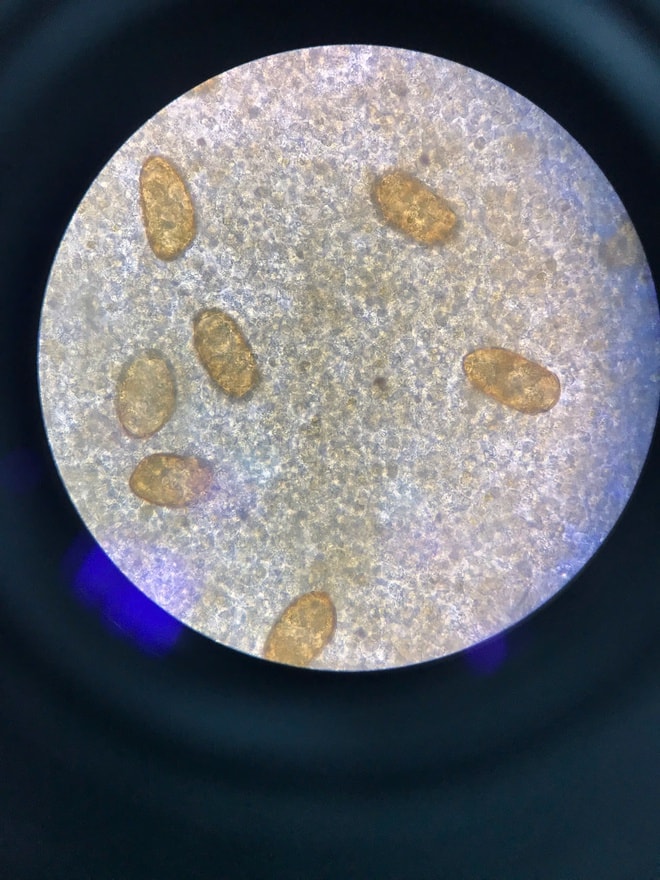 Bị nhiễm ký sinh trùng cần đi khám và điều trị ở đâu?- Ảnh 3. Bị nhiễm ký sinh trùng cần đi khám và điều trị ở đâu?- Ảnh 3.