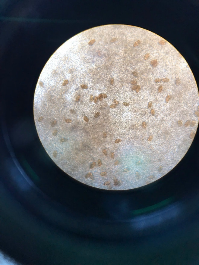 Bị nhiễm ký sinh trùng cần đi khám và điều trị ở đâu?- Ảnh 2. Bị nhiễm ký sinh trùng cần đi khám và điều trị ở đâu?- Ảnh 2.