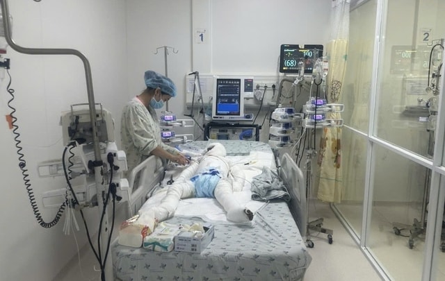 Bé trai ở Tây Ninh bị cha đổ xăng phóng hoả đã khoẻ lại- Ảnh 1. Bé trai ở Tây Ninh bị cha đổ xăng phóng hoả đã khoẻ lại- Ảnh 1.