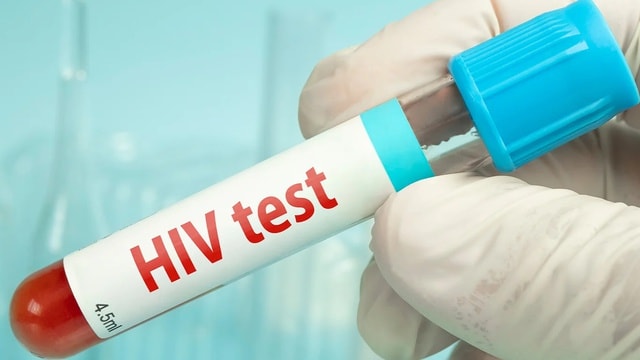 Sử dụng bao cao su an toàn, giải pháp an toàn trong phòng bệnh HIV- Ảnh 2.