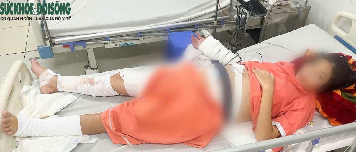 Bác sĩ Võ Thái Trung, BVĐK Bình Dương kể về ca ghép tạm bàn tay vào chân hiếm gặp, cứu mẹ và hai thai nhi- Ảnh 4. Bác sĩ Võ Thái Trung, BVĐK Bình Dương kể về ca ghép tạm bàn tay vào chân hiếm gặp, cứu mẹ và hai thai nhi- Ảnh 4.