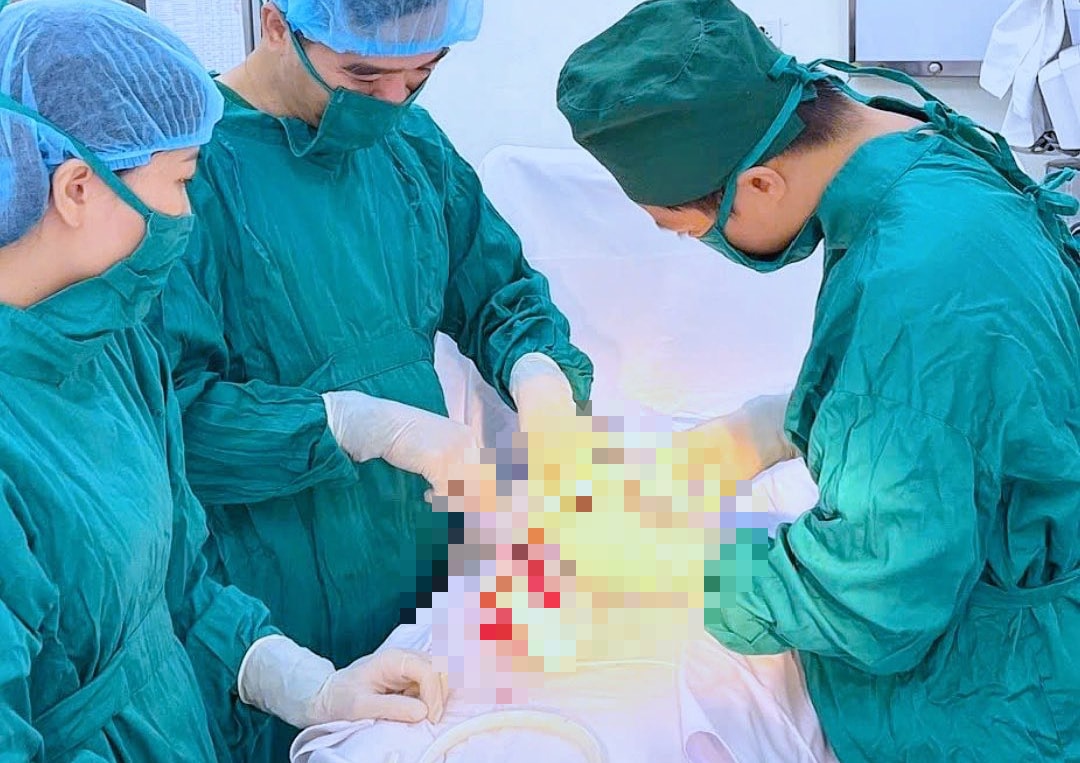 Ca mổ trong đêm khuya cứu sống sản phụ chửa ngoài tử cung vỡ, trụy mạch- Ảnh 1. Ca mổ trong đêm khuya cứu sống sản phụ chửa ngoài tử cung vỡ, trụy mạch- Ảnh 1.