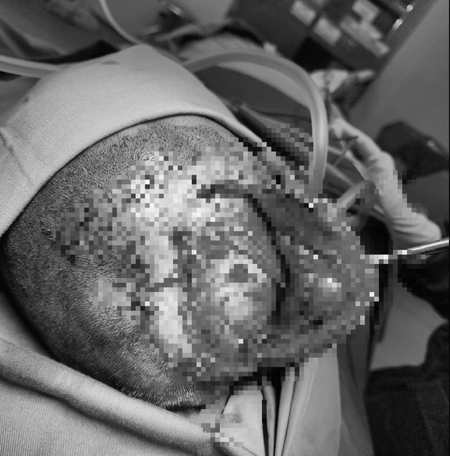 Vụ nhiều người thương vong sau tai nạn trên cao tốc: Tình trạng sức khỏe các nạn nhân hiện ra sao?- Ảnh 1. Vụ nhiều người thương vong sau tai nạn trên cao tốc: Tình trạng sức khỏe các nạn nhân hiện ra sao?- Ảnh 1.