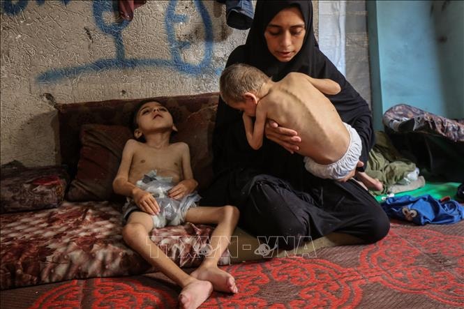 Hàng nghìn trẻ em ở Gaza nhập viện vì suy dinh dưỡng cấp tính- Ảnh 1. Hàng nghìn trẻ em ở Gaza nhập viện vì suy dinh dưỡng cấp tính- Ảnh 1.