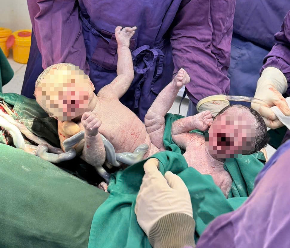 Cứu người phụ nữ bị tiền sản giật cùng 2 bé trai song sinh- Ảnh 1.