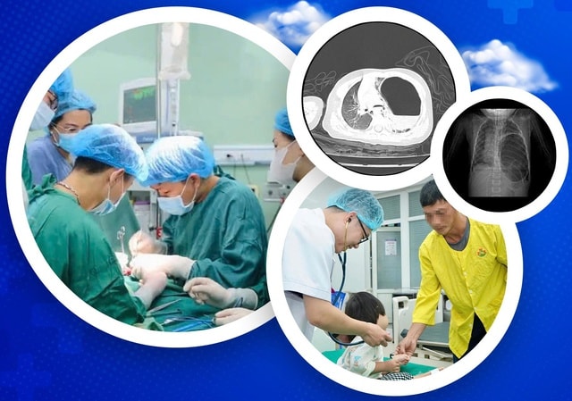 Phẫu thuật cấp cứu cứu sống trẻ 29 tháng tuổi bị thoát vị hoành nghẹt nguy hiểm- Ảnh 1.