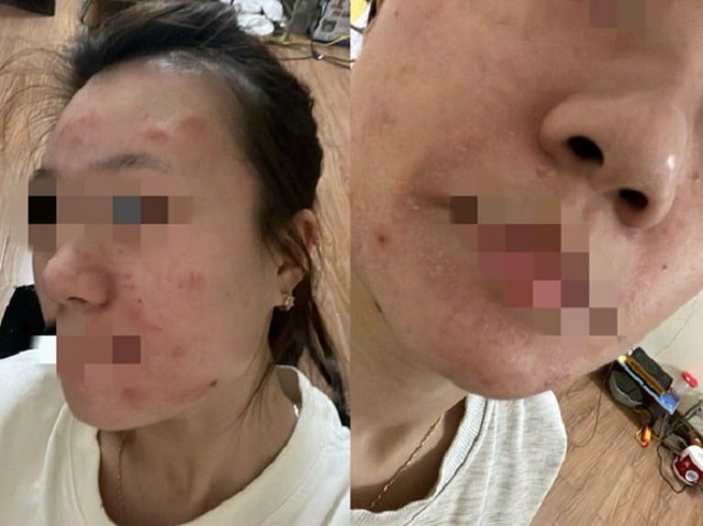 Đốt rác tự phát, nguyên nhân làm nghiêm trọng thêm ô nhiễm không khí- Ảnh 6. Đốt rác tự phát, nguyên nhân làm nghiêm trọng thêm ô nhiễm không khí- Ảnh 6.