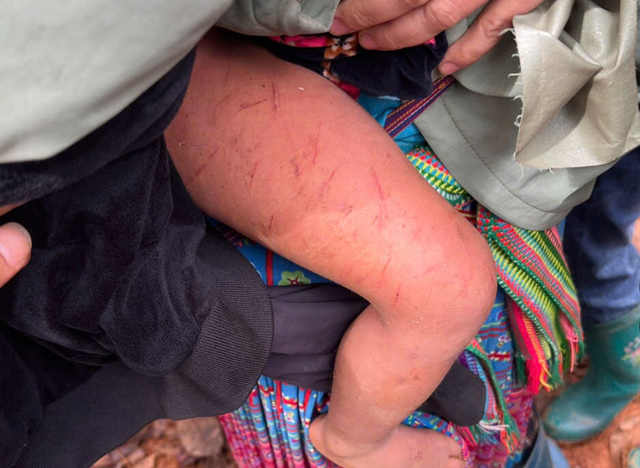 Đêm mưa rét kinh hoàng của bé 4 tuổi lạc trong rừng cao su- Ảnh 1. Đêm mưa rét kinh hoàng của bé 4 tuổi lạc trong rừng cao su- Ảnh 1.