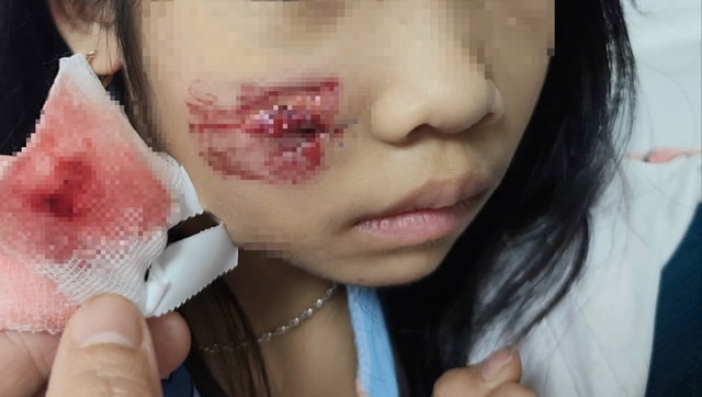 Đặt bẫy bắt linh trưởng quý hiếm thường kiếm ăn ở khu dân cư- Ảnh 2.