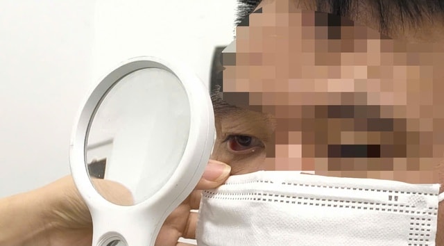 Người đàn ông bị rận mu hành hạ suốt một năm- Ảnh 2.