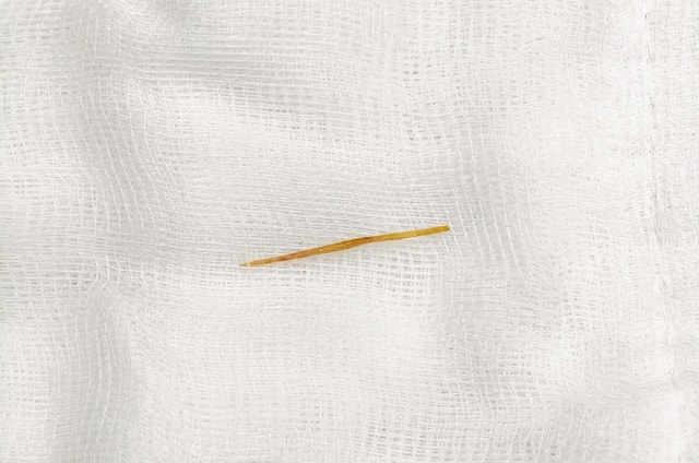 Thủng ruột do thói quen rất nhiều người mắc- Ảnh 2.