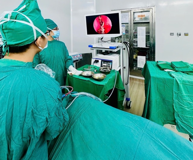 Bác sĩ lấy dị vật vôi hóa tồn tại nhiều năm trong mũi bệnh nhân- Ảnh 1.