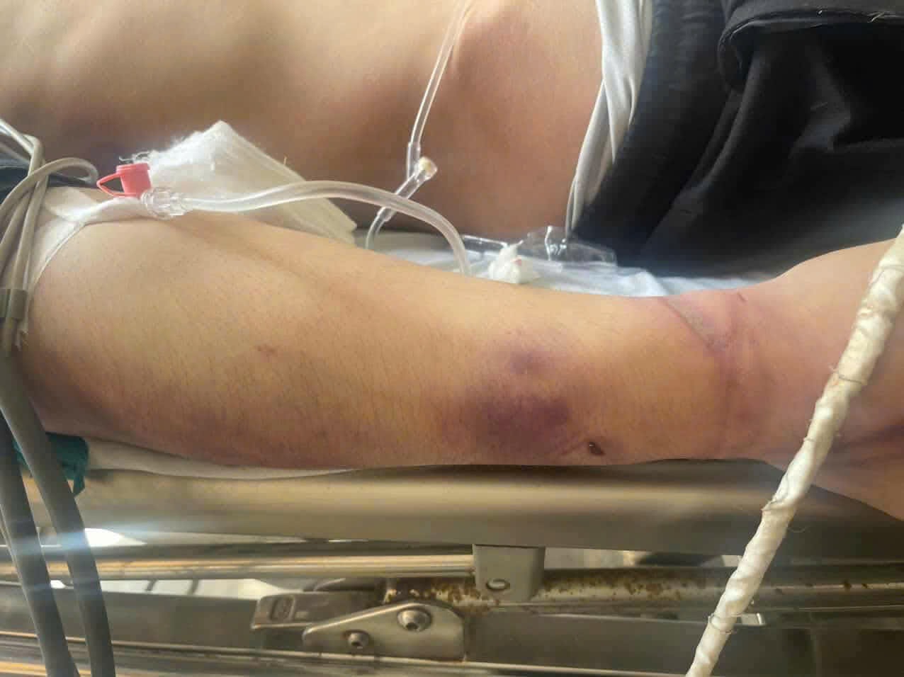 Điều tra vụ học viên tử vong sau 2 ngày nhập học- Ảnh 1. Điều tra vụ học viên tử vong sau 2 ngày nhập học- Ảnh 1.