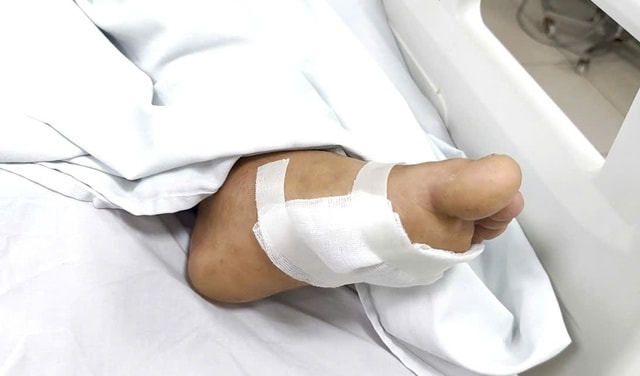 Chủ quan với vết xước nhỏ, nhiều bệnh nhân uốn ván phải nhập viện thở máy- Ảnh 2.