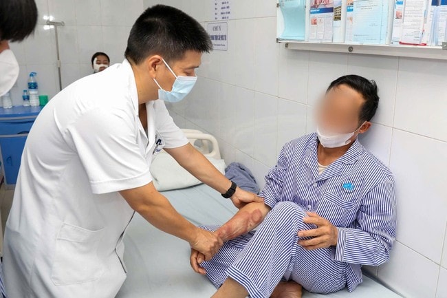 66 bệnh nhân phong được lắp chân giả, trao bước đi vững vàng- Ảnh 1.