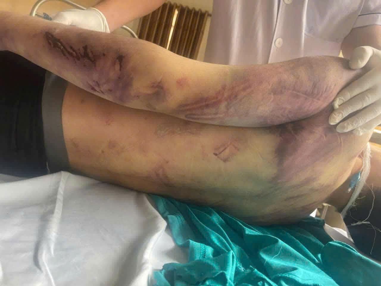 Tạm dừng trung tâm công tác xã hội có học viên tử vong sau 2 ngày nhập học- Ảnh 1. Tạm dừng trung tâm công tác xã hội có học viên tử vong sau 2 ngày nhập học- Ảnh 1.