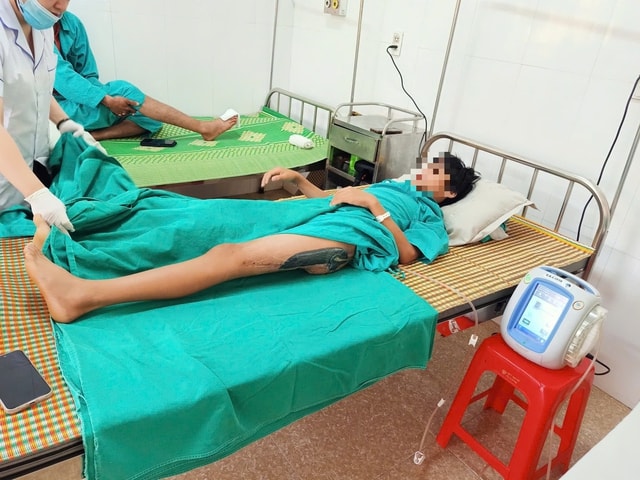 Tai nạn trên đường đi học về, bé trai 12 tuổi bị lóc da mông đùi diện rộng, trải qua 3 cuộc phẫu thuật phức tạp- Ảnh 2. Tai nạn trên đường đi học về, bé trai 12 tuổi bị lóc da mông đùi diện rộng, trải qua 3 cuộc phẫu thuật phức tạp- Ảnh 2.