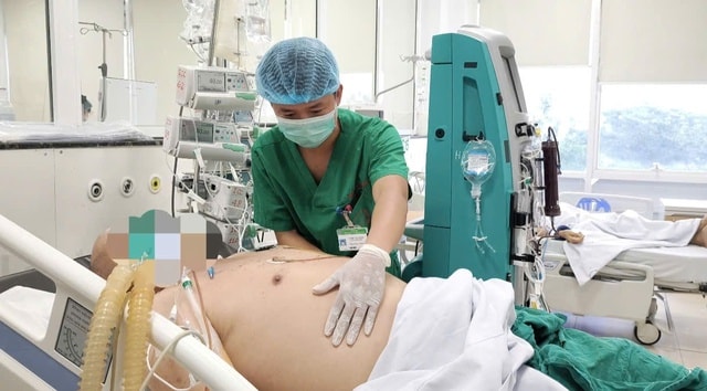 Sốt xuất huyết diễn biến nguy kịch ở bệnh nhân có nhiều bệnh nền- Ảnh 2.