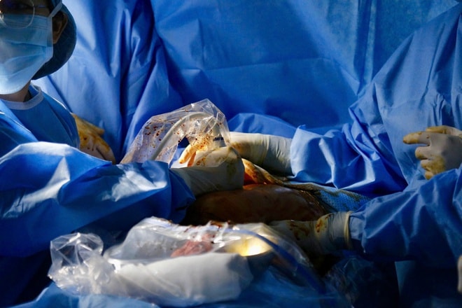 Ca can thiệp tim bào thai thứ 12 thành công chỉ trong 30 phút- Ảnh 4.