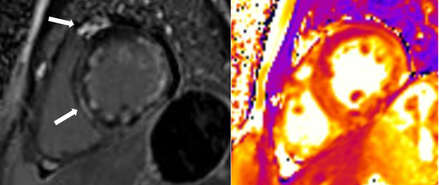 Đang chơi cầu lông, nam thanh niên 32 tuổi ngừng tim nguy kịch- Ảnh 2.