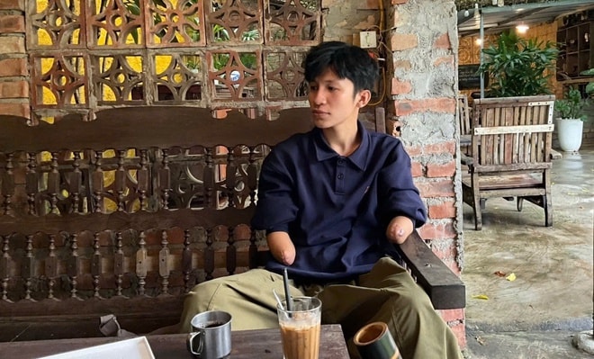 Chàng trai mồ côi mất 2 tay lập kênh TikTok truyền nghị lực sống- Ảnh 4.