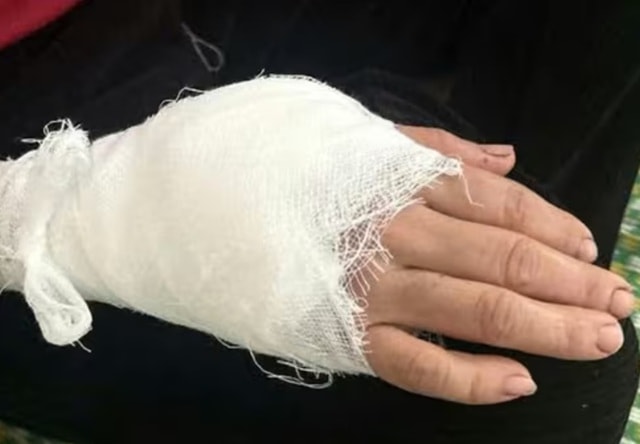 Video khỉ đuôi lợn vào nhà dân tấn công khiến người phụ nữ bị khâu 15 mũi- Ảnh 2.