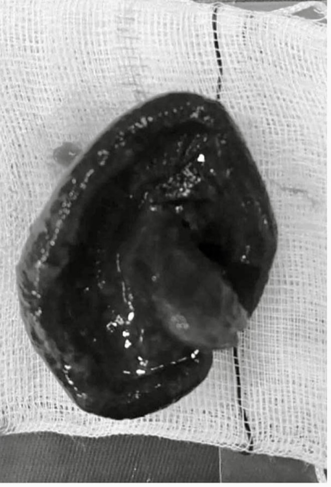 Liên tiếp ca mắc dị vật nguy hiểm, bác sĩ cảnh báo nguy cơ đe dọa tính mạng- Ảnh 5.