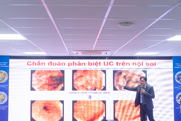 Vì sao nội soi tiêu hóa và sinh thiết chuẩn có vai trò quyết định trong điều trị bệnh viêm loét đại tràng?- Ảnh 2.