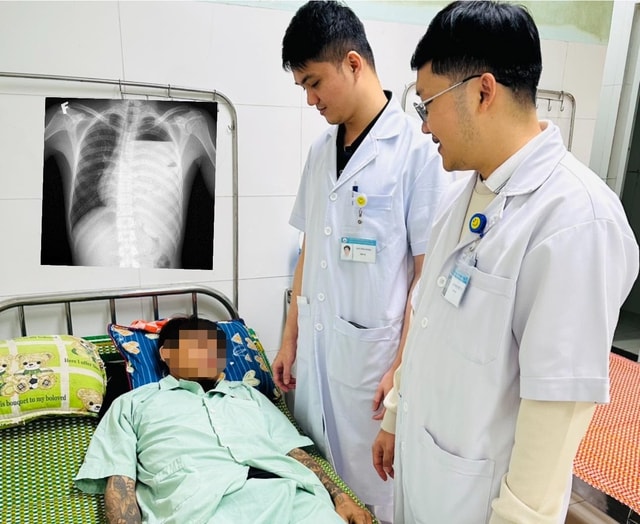 Cứu lá phổi suýt bị hủy hoại do tràn mủ màng phổi phức tạp- Ảnh 1.