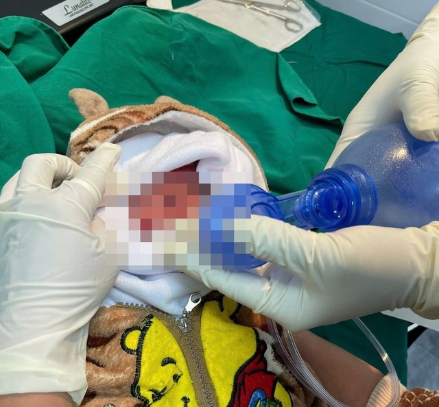 Cấp cứu kịp thời, chuyển tuyến an toàn ca sinh non 28 tuần nặng 900 gram- Ảnh 2.