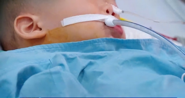 Cập nhật sức khỏe 3 bệnh nhân ở Ninh Bình ngộ độc sau khi ăn hạt củ đậu- Ảnh 2.