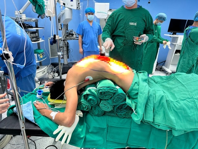 10 giờ phẫu thuật giải cứu người đàn ông 'cong như con tôm' , 7 năm cúi mặt xuống đất- Ảnh 2.