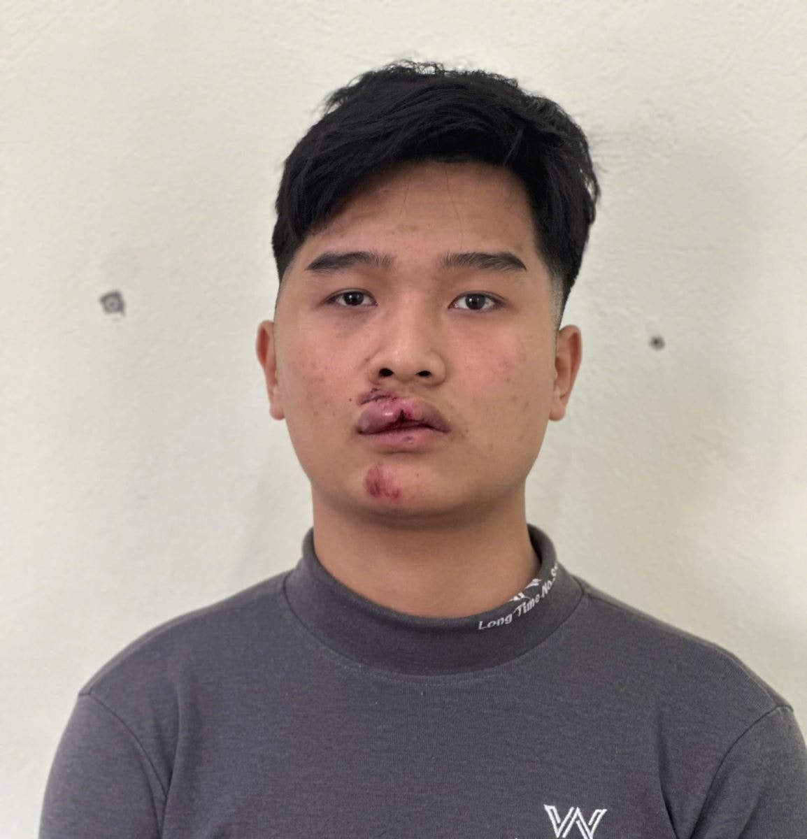 Uống rượu, vượt chốt kiểm tra nồng độ cồn, nam thanh niên điều khiển xe máy tông đại úy CSGT- Ảnh 2.