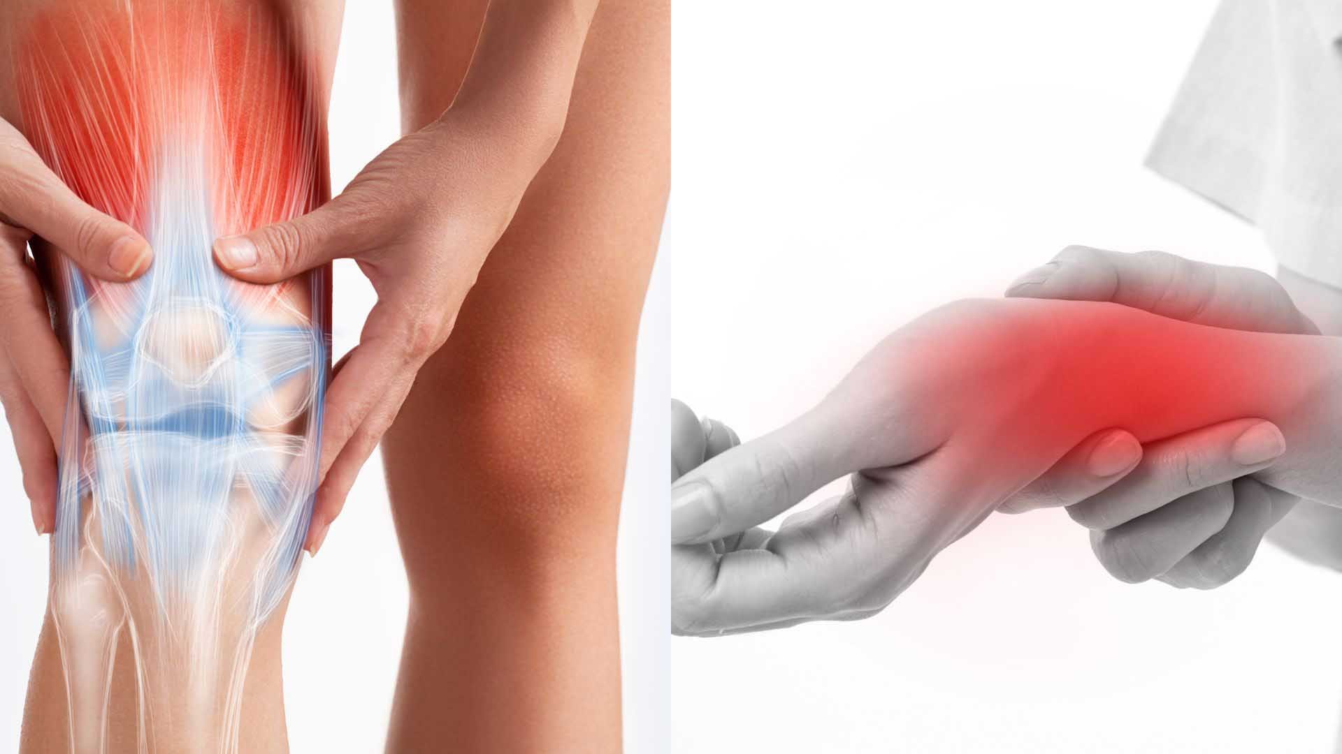 Đau khớp mùa đông: Nguyên nhân và các mẹo đơn giản giúp giảm cứng khớp hiệu quả- Ảnh 1.