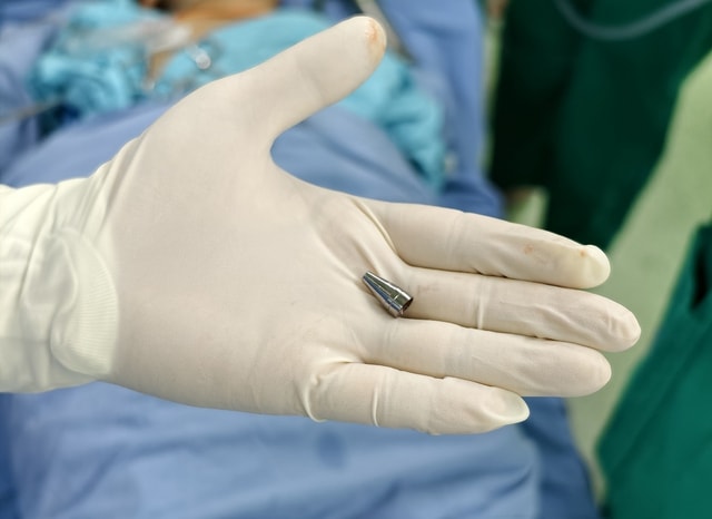 Đang ngồi học bỗng tím tái, bé trai 7 tuổi khiến bác sĩ hốt hoảng khi soi phế quản- Ảnh 2. Đang ngồi học bỗng tím tái, bé trai 7 tuổi khiến bác sĩ hốt hoảng khi soi phế quản- Ảnh 2.