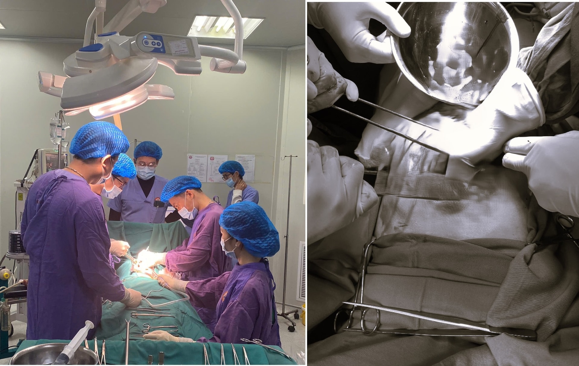 Dọn nhà đón Tết, bệnh nhân bị ngã từ độ cao 4 m, sốc đa chấn thương nguy kịch- Ảnh 1.