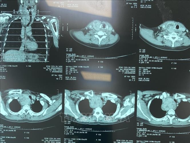 Chẩn đoán hình ảnh không cần phim in vào Quỹ BHYT chi trả- Ảnh 1. Chẩn đoán hình ảnh không cần phim in vào Quỹ BHYT chi trả- Ảnh 1.