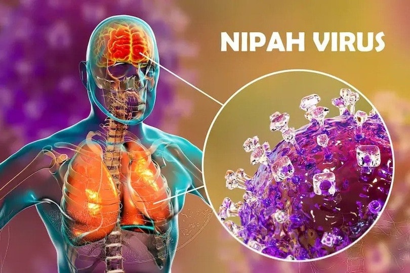 Bộ Y tế hướng dẫn giám sát và phòng bệnh do virus Nipah ở người- Ảnh 2.