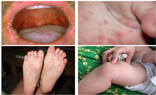 Hơn 510.000 lượt người bệnh khám, cấp cứu trong 8 ngày Tết- Ảnh 3. Hơn 510.000 lượt người bệnh khám, cấp cứu trong 8 ngày Tết- Ảnh 3.