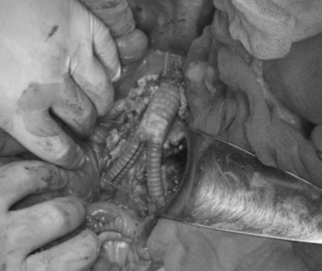 3 giờ căng thẳng cứu bệnh nhân nguy cơ tử vong rất cao giữa kỳ nghỉ Tết- Ảnh 1.