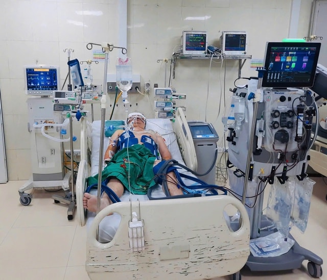 Người đàn ông 47 tuổi ngừng tim, mất gần 1 giờ được cứu sống: Hồi chuông cảnh báo bệnh tim mạch âm thầm- Ảnh 1. Người đàn ông 47 tuổi ngừng tim, mất gần 1 giờ được cứu sống: Hồi chuông cảnh báo bệnh tim mạch âm thầm- Ảnh 1.