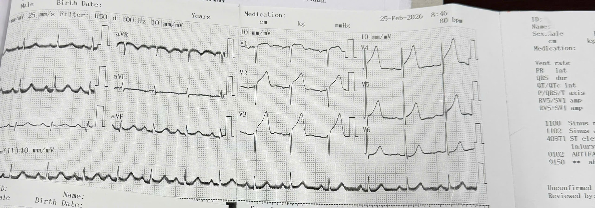 Nhồi máu cơ tim và cuộc đua từng phút trong phòng cấp cứu- Ảnh 1.