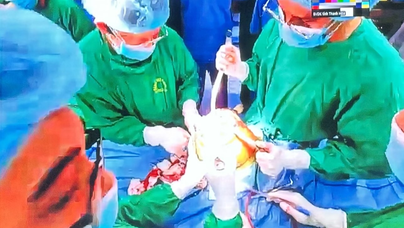 Phẫu thuật thay khớp gối cho cụ bà 76 tuổi bằng phương pháp bảo tồn cơ- Ảnh 1.